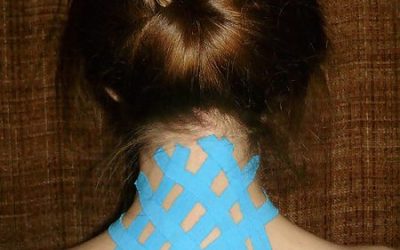 Taping kinesiologico