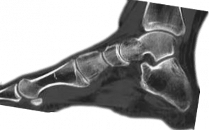 lastra-radiologia-fisioterapisti