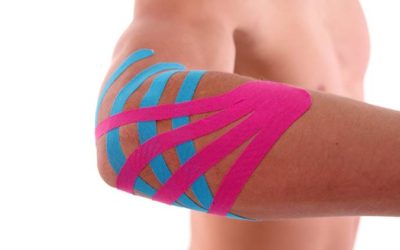 Kinesio taping gomito