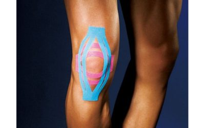 Kinesio taping ginocchio