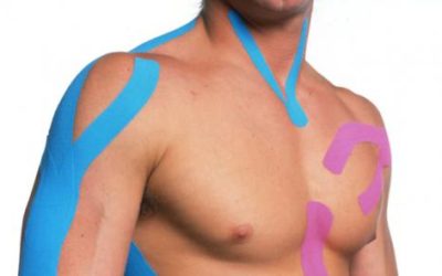 Kinesio taping spalla