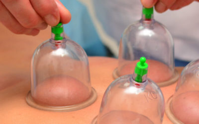 Cupping